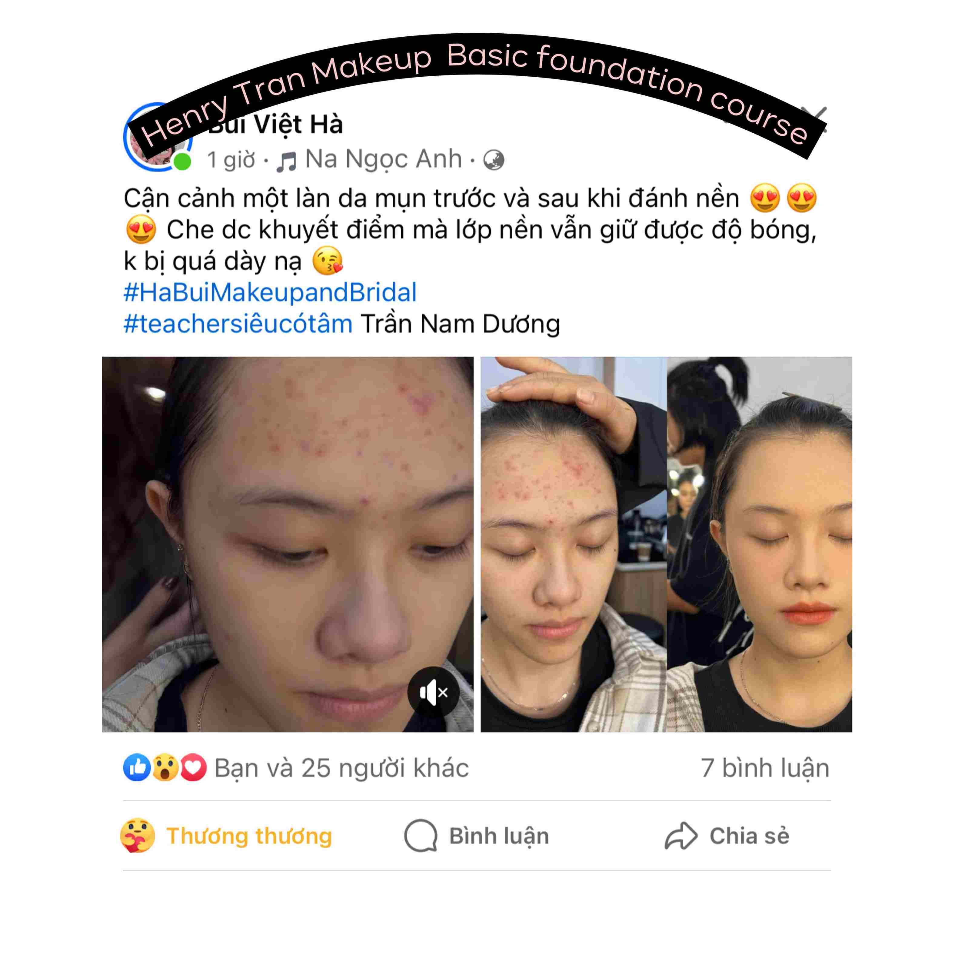 Feedback